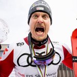 Haare ab & Party mit Karacho! So zelebriert Feller die Kugel